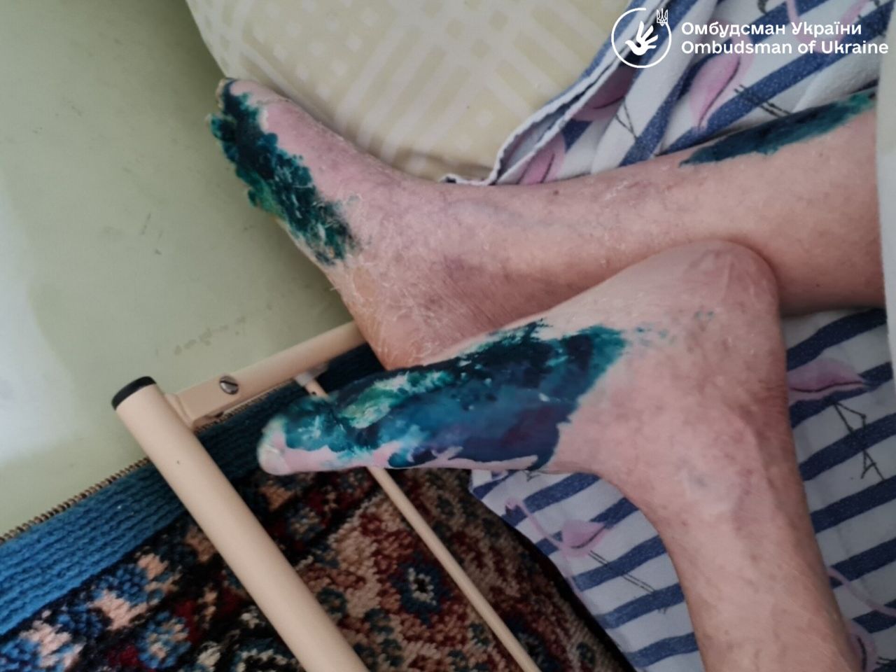 Без доступа к питьевой воде и собственным деньгам: гериатрический пансионат во Львове попал в скандал